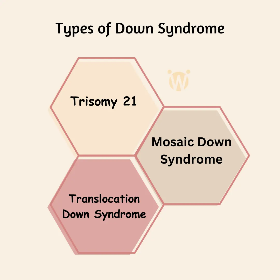 Types of Down syndrome